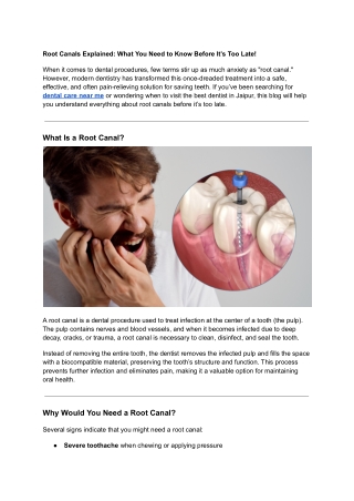 Root Canals Explained_ What You Need to Know Before It’s Too Late