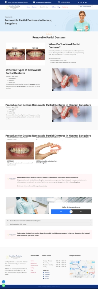 Removable Partial Dentures in Hennur, Bangalore - CureAlign Dentistry