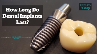 How Long Do Dental Implants Last