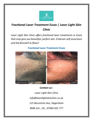 Fractional Laser Treatment Essex | Laser Light Skin Clinic