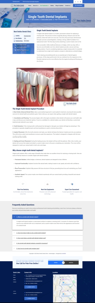 Single Tooth Dental Implants in Koramangala Bengaluru