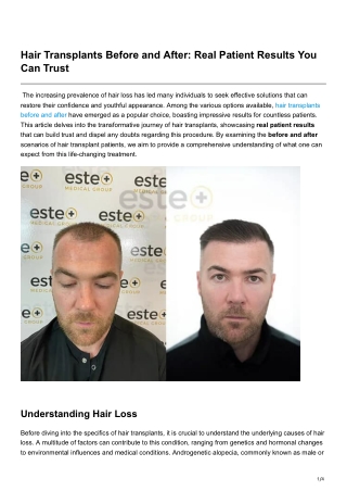 Hair Transplants Before and After Real Patient Results You Can Trust