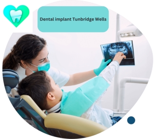 Dental implant Tunbridge Wells