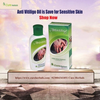 How Safe Is Anti Vitiligo Oil for Sensitive Skin
