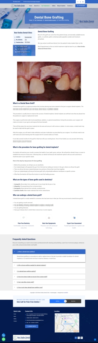 Dental Bone Grafting in Koramangala 8th Block, Bengaluru