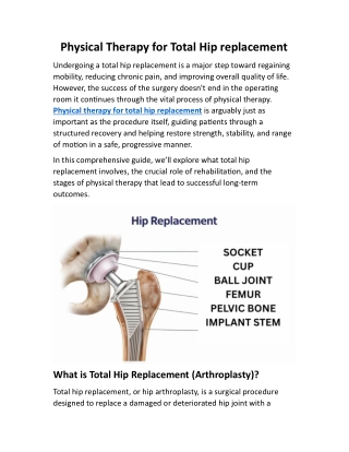 Physical Therapy for Total Hip replacement
