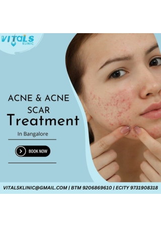 Best Dermatologist in Bangalore – VitalsKlinic