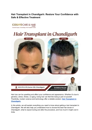 Hair Transplant in Chandigarh: Safe, Effective & Confidence-Boosting Treatment