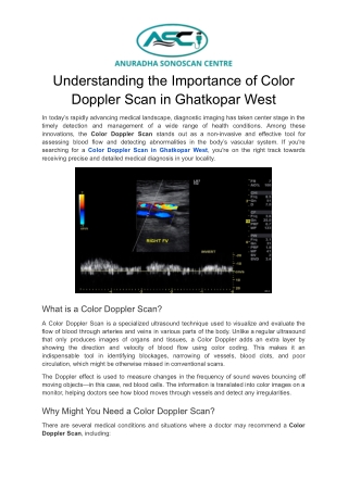 Understanding the Importance of Color Doppler Scan in Ghatkopar West