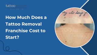 How Much Does a Tattoo Removal Franchise Cost to Start