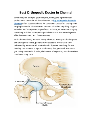 Best Orthopedic Doctor in Chennai