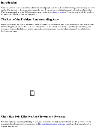 Clear Skin 101: Effective Acne Treatments Revealed