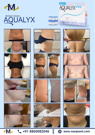Aqyalux Before and After