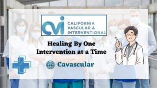 Varicose Veins Surgery in Los Angeles - Cavascular