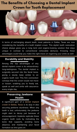The Benefits of Choosing a Dental Implant Crown for Tooth Replacement