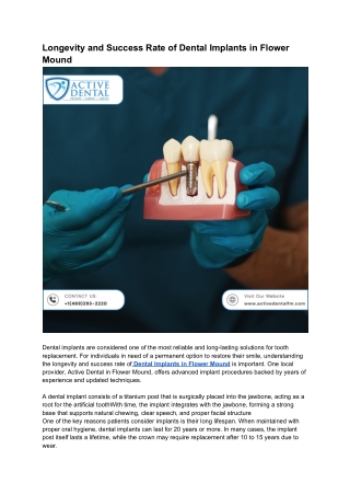Longevity and Success Rate of Dental Implants in Flower Mound