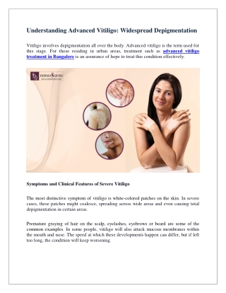 Understanding Advanced Vitiligo Widespread Depigmentation