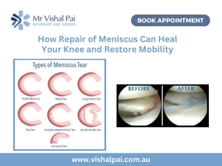 How Repair of Meniscus Can Heal Your Knee and Restore Mobility