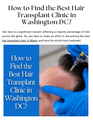 How to Find the Best Hair Transplant Clinic in Washington DC