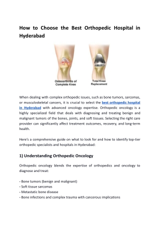 How to Choose the Best Orthopedic Hospital in Hyderabad