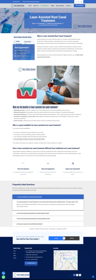 Laser-Assisted Root Canal Treatment in Koramangala, Bengaluru