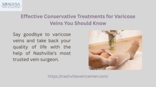Effective Conservative Treatments for Varicose Veins You Should Know