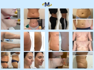 aqualyx before and after  Manju Enterprises Pvt. Ltd.