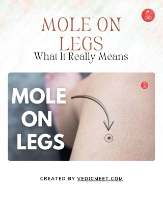 Mole on Legs - What It Really Means