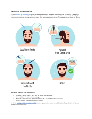 Autologous Hair Transplant in Delhi