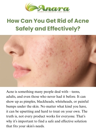 How Can You Get Rid of Acne Safely and Effectively
