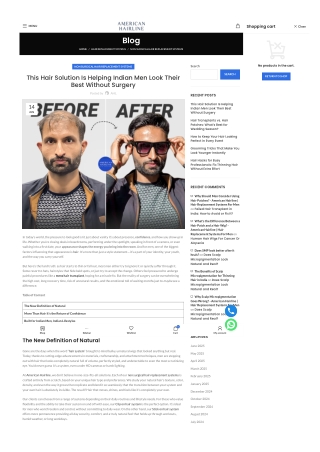 This Hair Solution Is Helping Indian Men Look Their Best Without Surgery