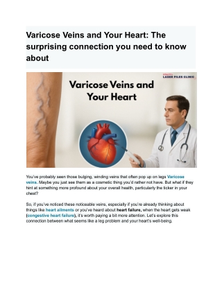 Varicose Veins and Your Heart_ The surprising connection you need to know about