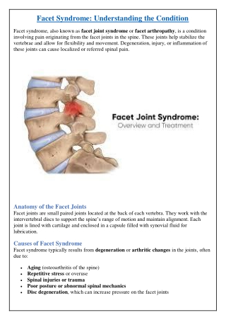 Facet Syndrome: Understanding the Condition