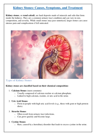 Kidney Stones: Causes, Symptoms, and Treatment