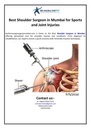 Best Shoulder Surgeon in Mumbai for Sports and Joint Injuriesarthroscopysurgerym
