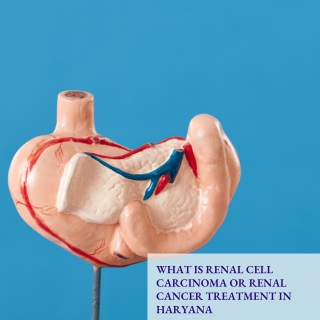 What is Renal Cell Carcinoma or Renal Cancer Treatment in Haryana