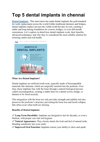 Top 5 dental implants in chennai