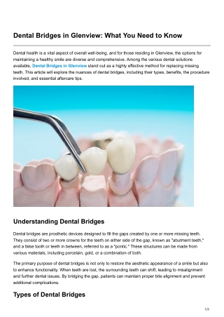 Dental Bridges in Glenview What You Need to Know