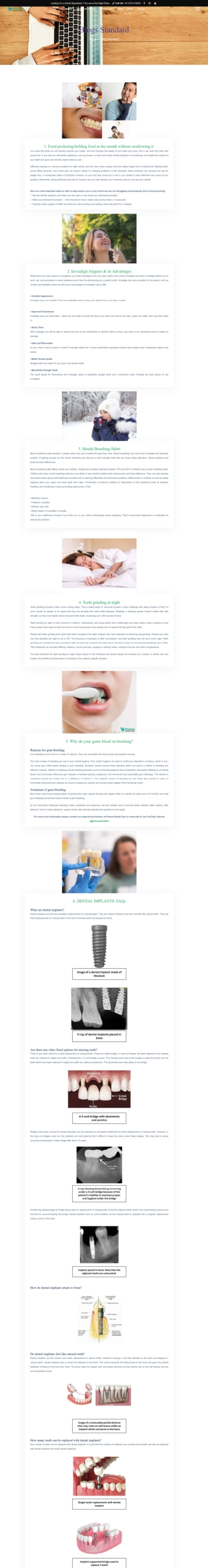 Dental-Blogs-Prisma-Dental-in-Kanakapura-Road-Konanakunte-Cross