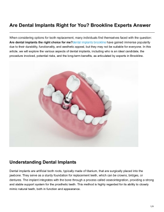 Are Dental Implants Right for You Brookline Experts Answer