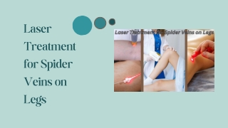 Laser Treatment for Spider Veins on Legs