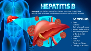 Complete Guide on Hepatitis Treatment: Symptoms, Causes, and Cure