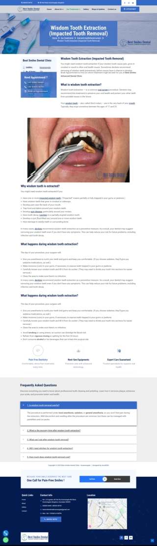 Wisdom Teeth Removal in Koramangala Bengaluru Best Smiles