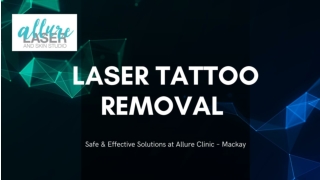 Laser Tattoo Removal