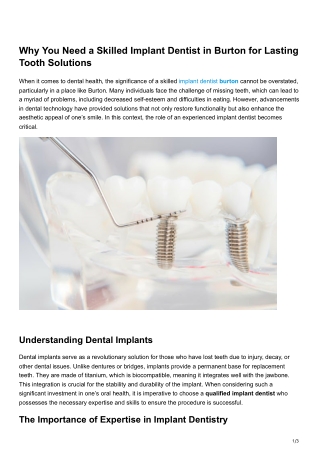 Why You Need a Skilled Implant Dentist in Burton for Lasting Tooth Solutions