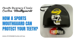 How a Sports Mouthguard Can Protect Your Teeth