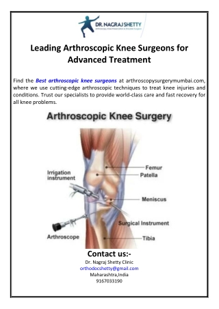 Leading Arthroscopic Knee Surgeons for Advanced Treatment