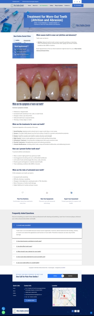 Worn Out Teeth Treatment in Koramangala Bengaluru