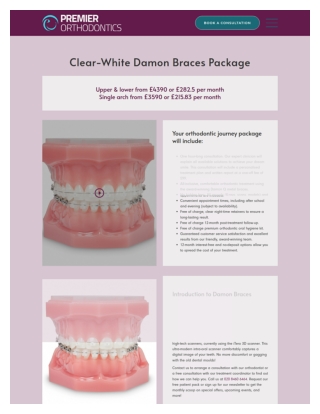 Invisible Damon Braces in UK