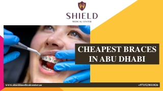 CHEAPEST BRACES IN ABU DHABI